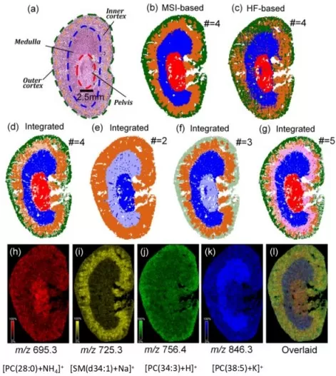Multi-modal fusion for automatic tissue segmentation mouse kidney ROI mapping